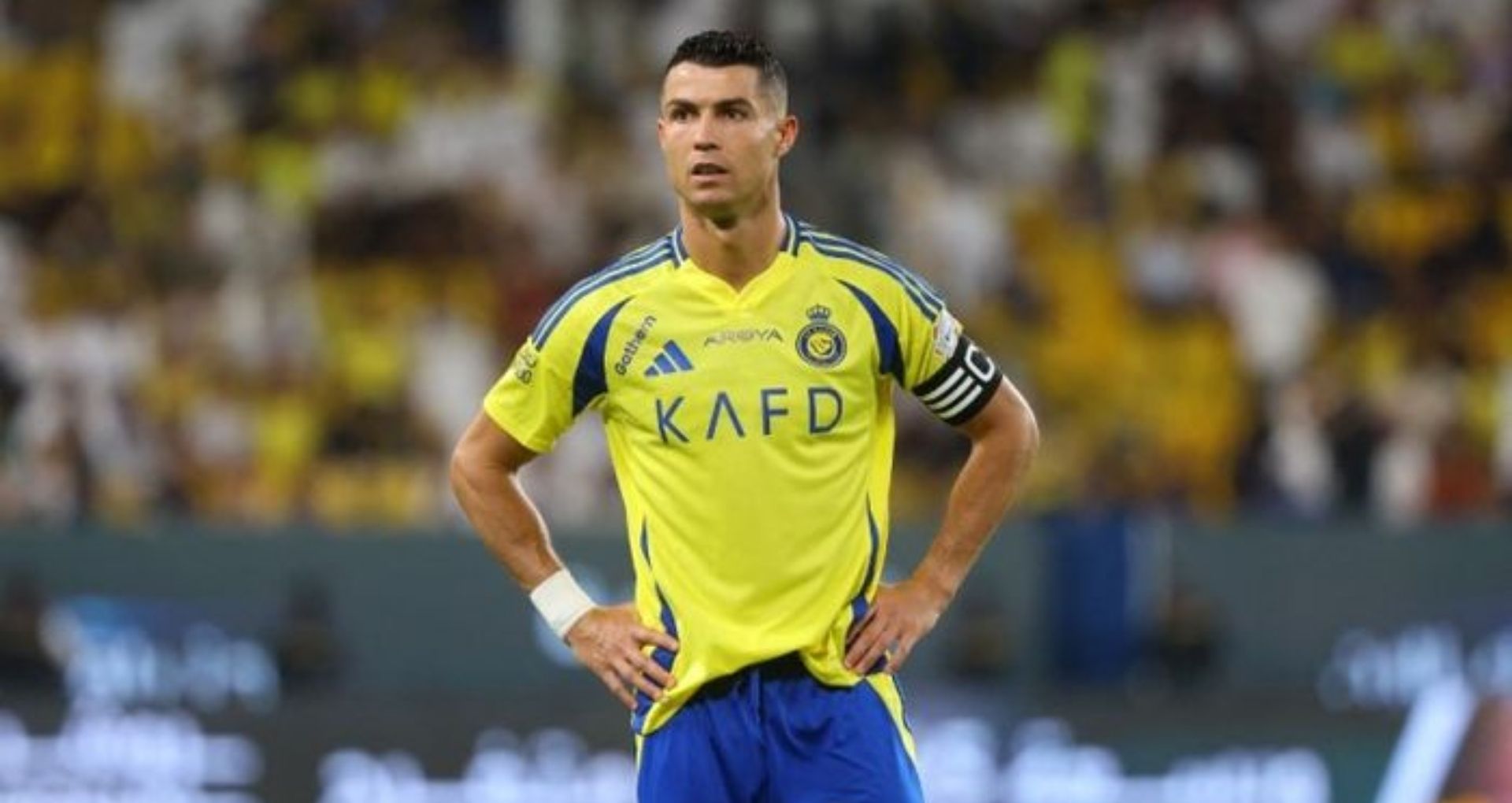 Apakah Ronaldo Pernah Operasi Plastik? Ini Penjelasannya!